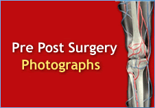Pre-post surgery Photographs